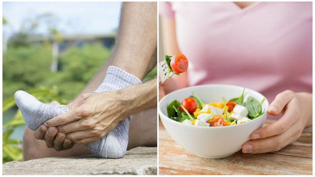 Dietary foods for the treatment of gout. 